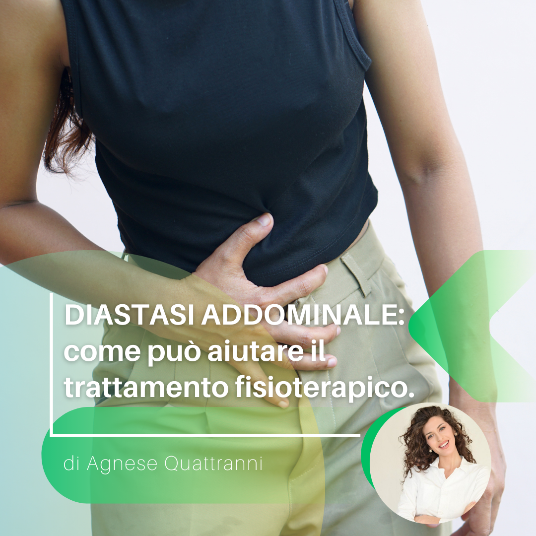 DIASTASI ADDOMINALE: come può aiutare il trattamento fisioterapico.